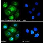 Estrogen Receptor beta Antibody in Immunocytochemistry (ICC/IF)