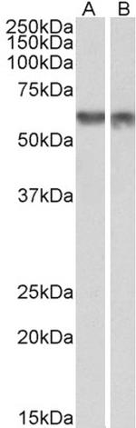 PDCD4 Antibody in Western Blot (WB)