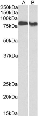 PKC beta Antibody in Western Blot (WB)