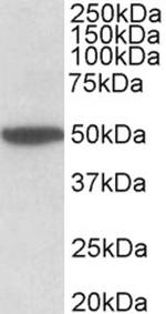 CHRM2 Antibody in Western Blot (WB)