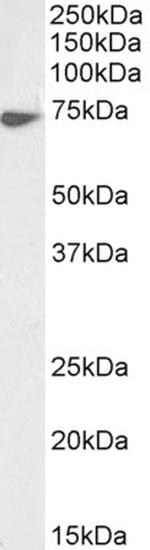 Lamin B1 Antibody in Western Blot (WB)