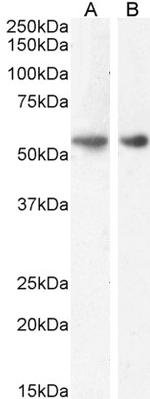 GLP1R Antibody in Western Blot (WB)