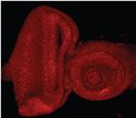 E2F1 Antibody in Immunohistochemistry (IHC)