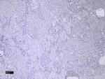 MMP3 Antibody in Immunohistochemistry (Paraffin) (IHC (P))