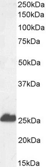 Calbindin D28K Antibody in Western Blot (WB)