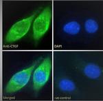 CTGF Antibody in Immunocytochemistry (ICC/IF)