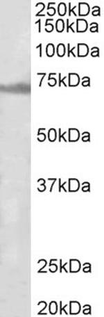 ENC1 Antibody in Western Blot (WB)