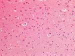 VCP Antibody in Immunohistochemistry (Paraffin) (IHC (P))