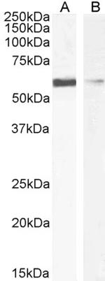 IDE Antibody in Western Blot (WB)