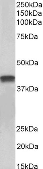 Cardiac Troponin T Antibody in Western Blot (WB)