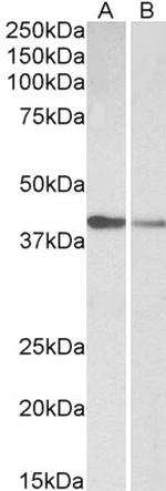 Cardiac Troponin T Antibody in Western Blot (WB)