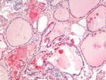 SGTA Antibody in Immunohistochemistry (Paraffin) (IHC (P))