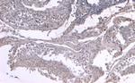 LIF Antibody in Immunohistochemistry (Paraffin) (IHC (P))