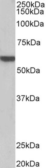 alpha-1b Adrenergic Receptor Antibody in Western Blot (WB)