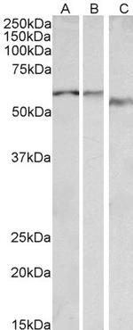 alpha-1b Adrenergic Receptor Antibody in Western Blot (WB)