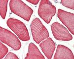 TNNT1 Antibody in Immunohistochemistry (Paraffin) (IHC (P))