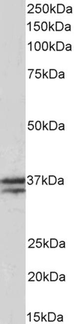 TNNT1 Antibody in Western Blot (WB)