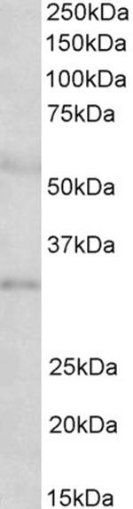 IGFBP-1 Antibody in Western Blot (WB)