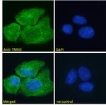 Cardiac Troponin I Antibody in Immunocytochemistry (ICC/IF)