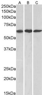 MMP14 Antibody in Western Blot (WB)