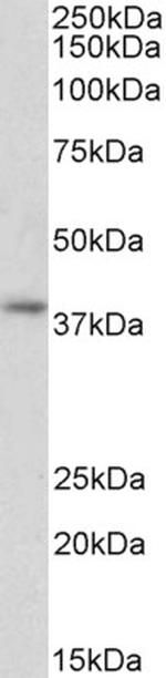 GNAI2 Antibody in Western Blot (WB)