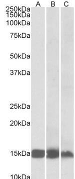 FABP3 Antibody in Western Blot (WB)