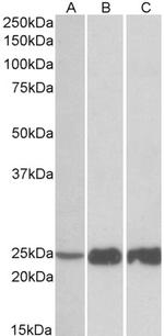 TNNI2 Antibody in Western Blot (WB)