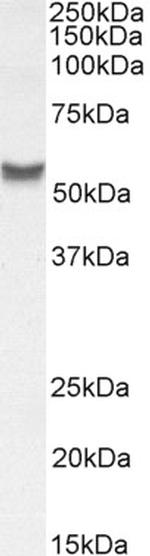 YLAT2 Antibody in Western Blot (WB)