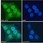 ATF6 Antibody in Immunocytochemistry (ICC/IF)