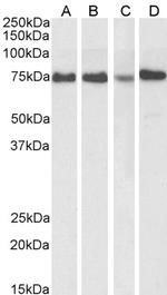 ATF6 Antibody in Western Blot (WB)