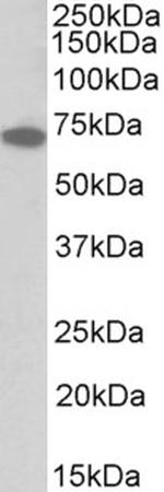 IFNGR1 (CD119) Antibody in Western Blot (WB)