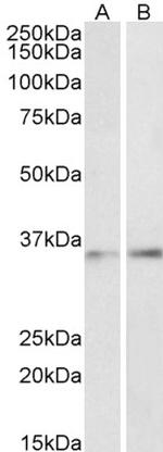 C/EBP beta Antibody in Western Blot (WB)