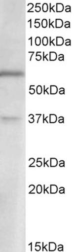 VGLUT2 Antibody in Western Blot (WB)