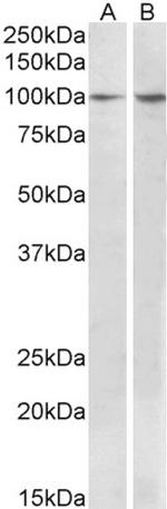 p130Cas Antibody in Western Blot (WB)