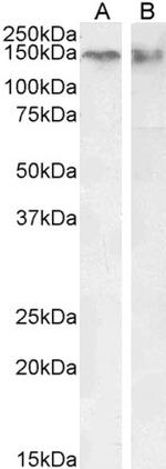 CTCF Antibody in Western Blot (WB)