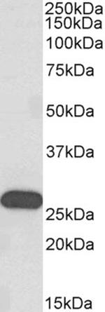 HOXC6 Antibody in Western Blot (WB)