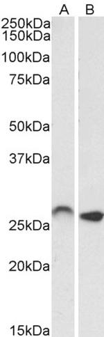 HOXC6 Antibody in Western Blot (WB)