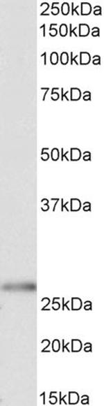 HOXC6 Antibody in Western Blot (WB)