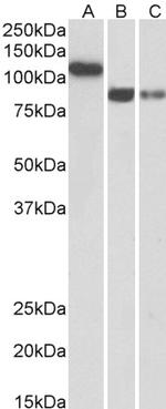 H-cadherin Antibody in Western Blot (WB)