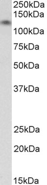 H-cadherin Antibody in Western Blot (WB)