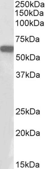 E2F1 Antibody in Western Blot (WB)