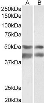 E2F4 Antibody in Western Blot (WB)