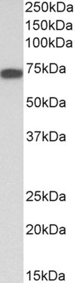 Kininogen 1 Antibody in Western Blot (WB)