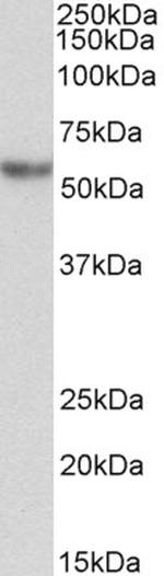 alpha-1 Antitrypsin Antibody in Western Blot (WB)