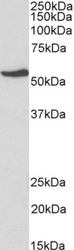 NR5A2 Antibody in Western Blot (WB)