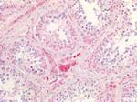 SR-BI Antibody in Immunohistochemistry (Paraffin) (IHC (P))