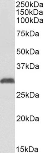 NAT1 Antibody in Western Blot (WB)