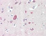 PTGDS Antibody in Immunohistochemistry (Paraffin) (IHC (P))