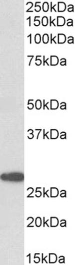 PTGDS Antibody in Western Blot (WB)