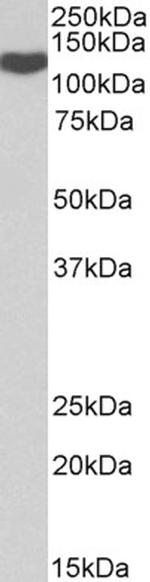 ADAM19 Antibody in Western Blot (WB)